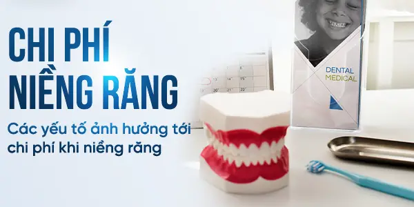 Chi phí niềng răng – Các yếu tố ảnh hưởng tới chi phí niềng răng - Nha khoa Minh Châu
