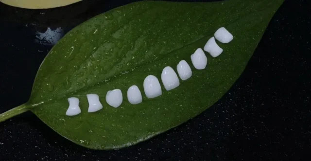 boc-rang-su-bao-nhieu-tien-1-rang-1