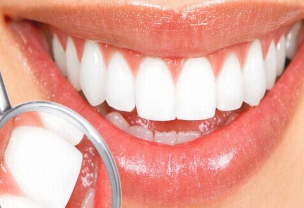Trám răng thẩm mỹ – Giải pháp bảo vệ và thẩm mỹ cho nụ cười