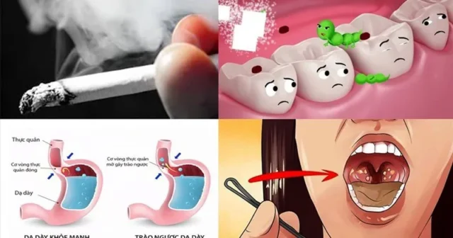 cac-tri-hoi-mieng-tư-ben-trong-1