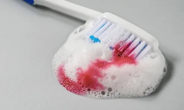 cach-chua-viem-nha-chu-tai-nha