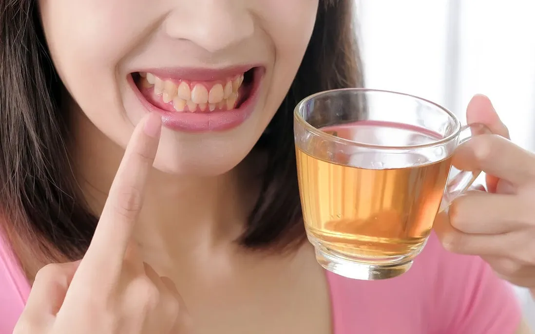 nhung-thuc-pham-lam-rang-o-vang