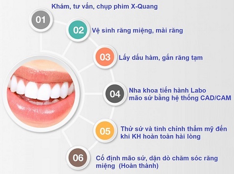 quy-trinh-trong-rang-su
