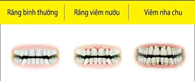 viem-nha-chu-2