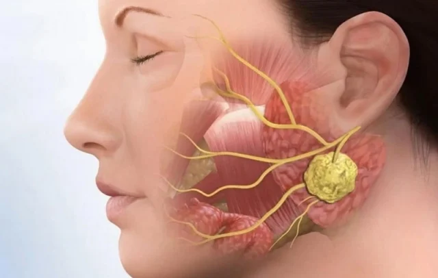 dau-khop-thai-duong-ham-4