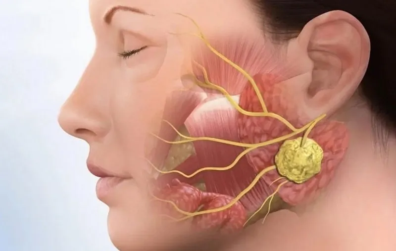 dau-khop-thai-duong-ham-4