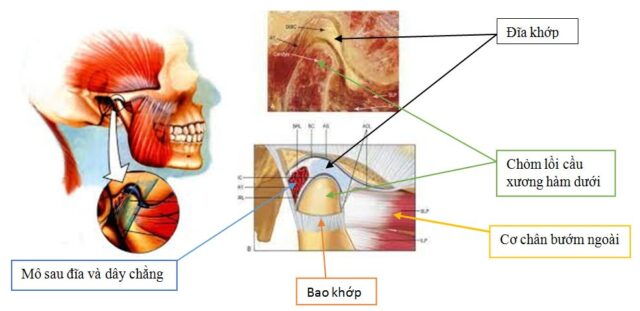 dau-khop-thai-duong-ham