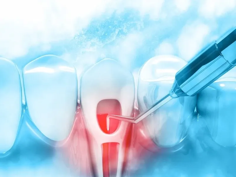 laser-trong-nha-khoa-1