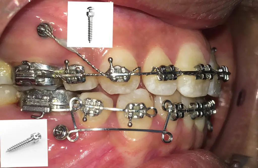 mini-vit-chinh-nha-1