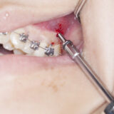 vit-chinh-nha-thai-nguyen