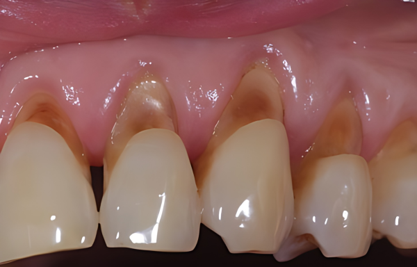 nguyen-nhan-va-cach-khac-phuc-tut-loi-hieu-qua-3