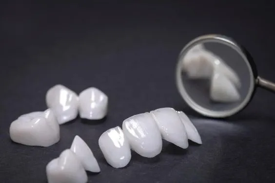 phuong-phap-dan-rang-composite-4