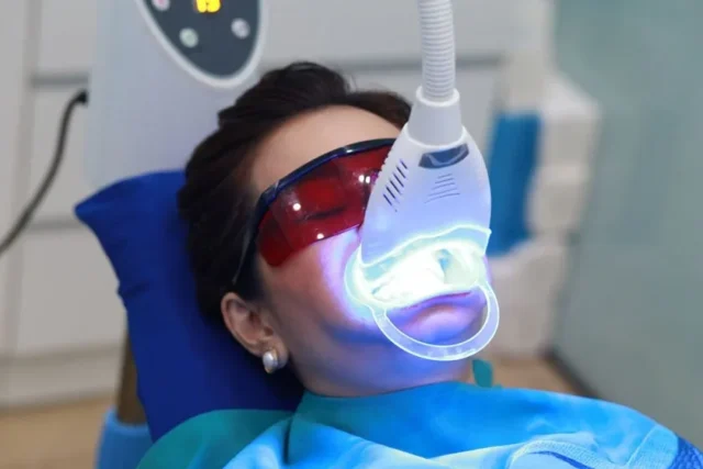 tay-trang-rang-plasma