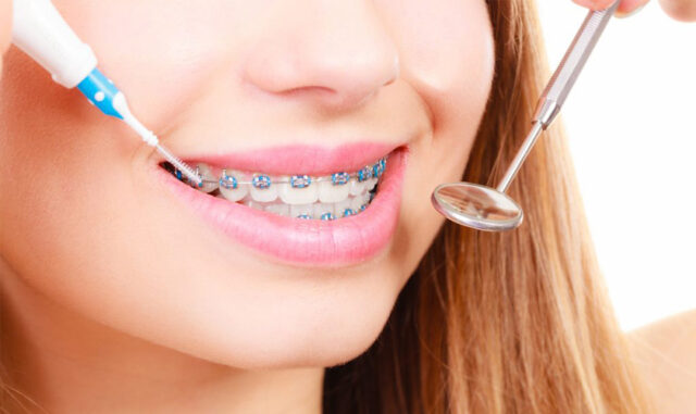 ve-sinh-rang-sau-nieng-2