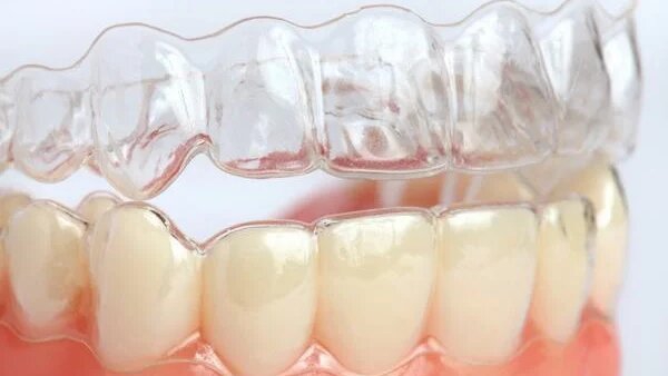 cach-giu-rang-trang-sau-khi-tay-3