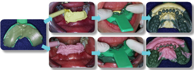 cach-lay-dau-ham-thao-lap-1