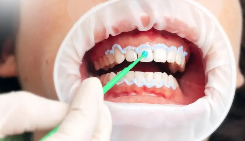 dang-cho-con-bu-co-tay-trang-rang-duoc-khong-1