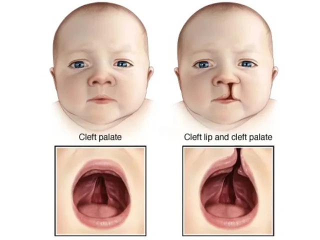 di-tat-bam-sinh-vung-mieng-moi-1