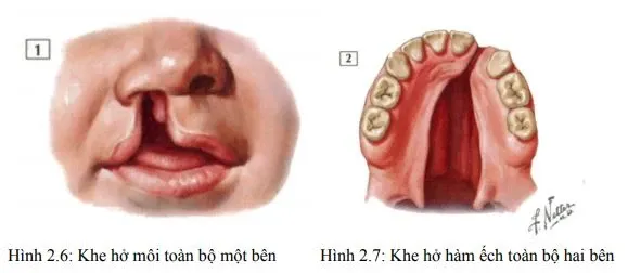 di-tat-bam-sinh-vung-mieng-moi-4