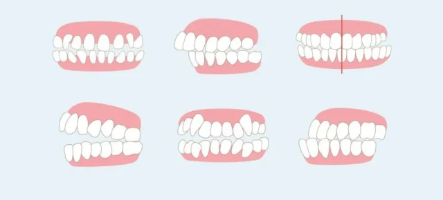 dieu-tri-bien-chung-do-dieu-tri-nha-khoa-3