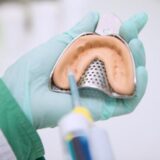 lay-dau-rang-co-dau-khong-2