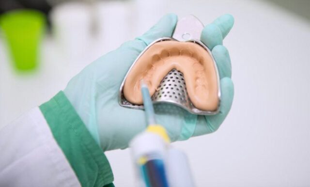 lay-dau-rang-de-nieng-1