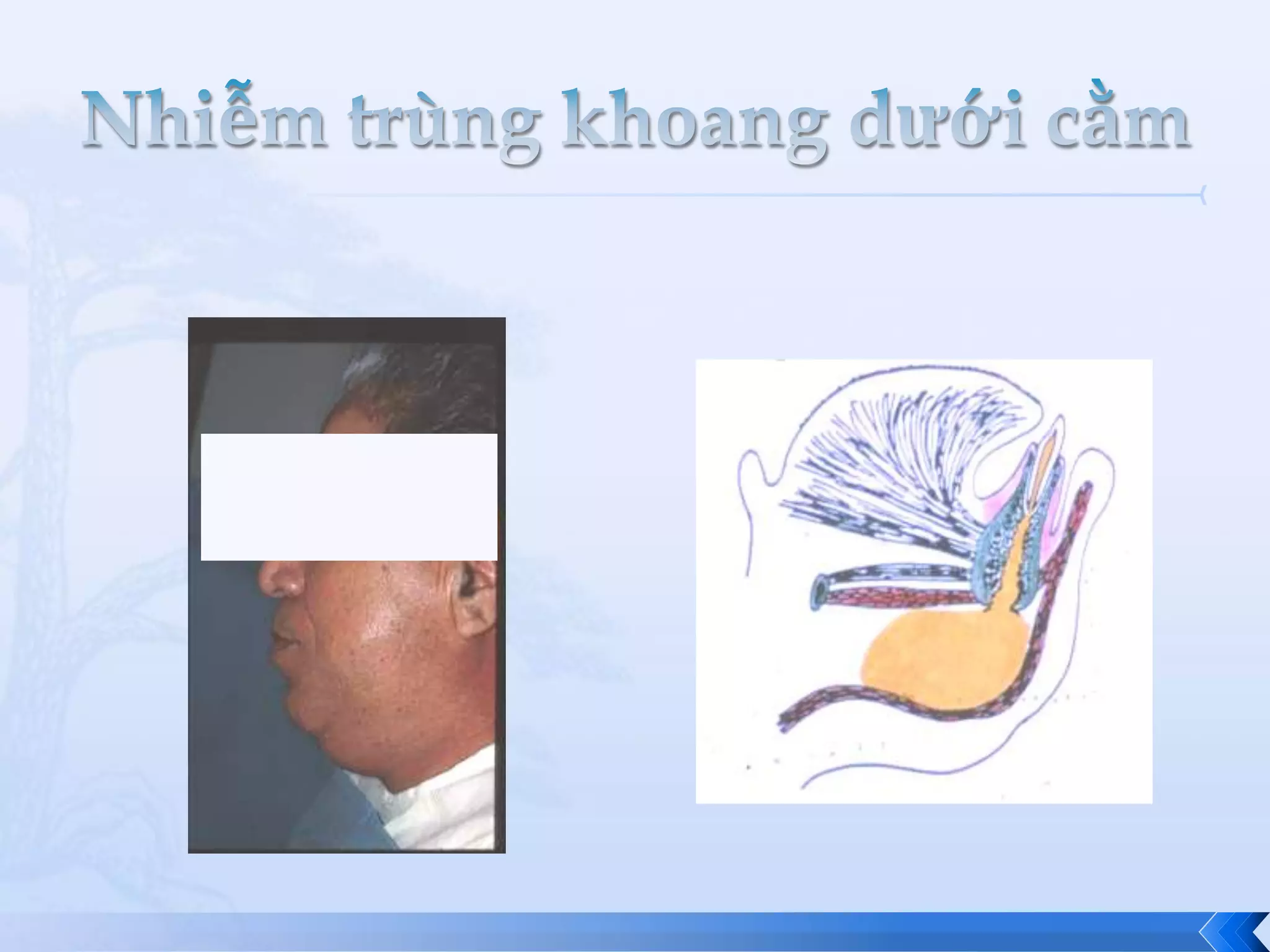 nhiem-trung-lan-toa-vung-ham-mat-3