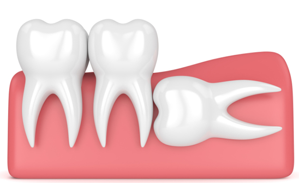 rang-moc-ngam-ham-duoi