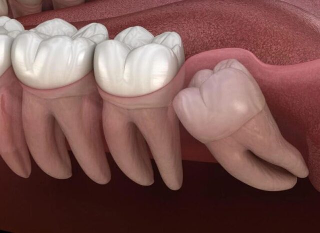 rang-so-8-moc-ngam-2