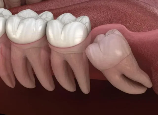 rang-so-8-moc-ngam-2