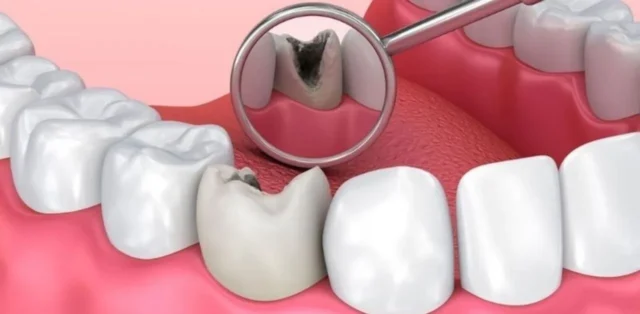 cách đánh răng sạch sẽ