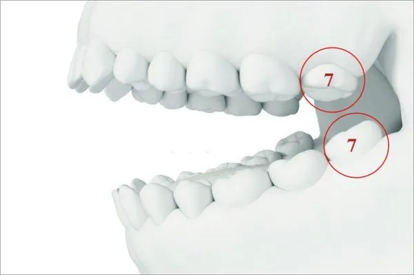 Khoảng Trống Răng Số 7