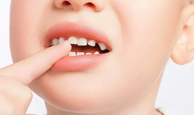 Quy Trình Thay Răng Diễn Ra