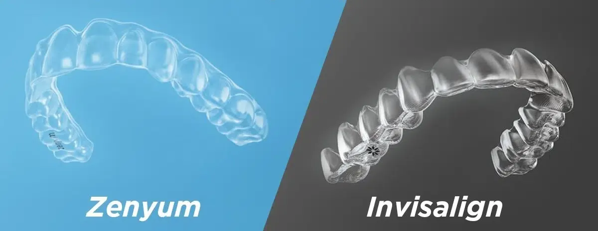 So sánh chi phí và thời gian điều trị