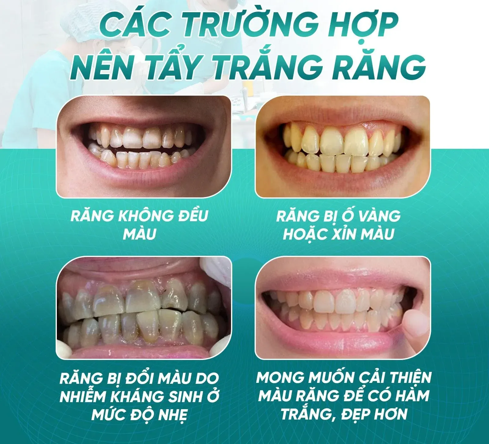 tẩy trắng răng có hại men răng không