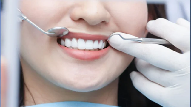 Câu hỏi về Cắt lợi thẩm mỹ