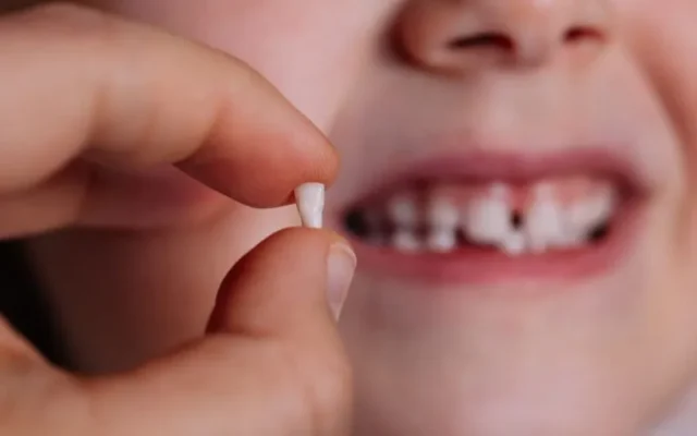 Hướng dẫn chi tiết nhổ răng cho trẻ