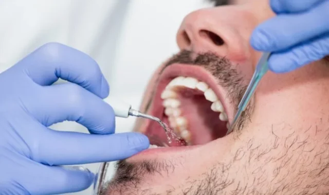 răng mọc ngầm có cần nhổ không