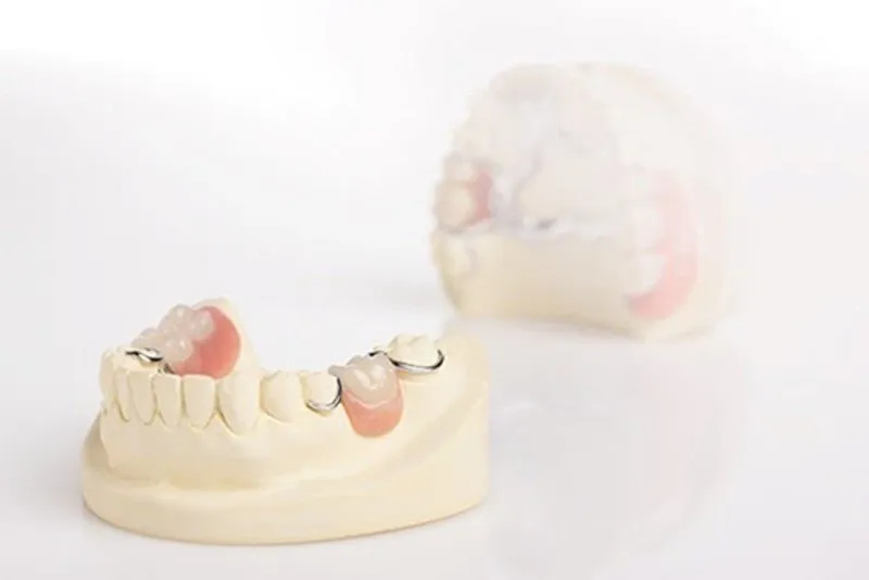 Răng hàm số 5 có thay không