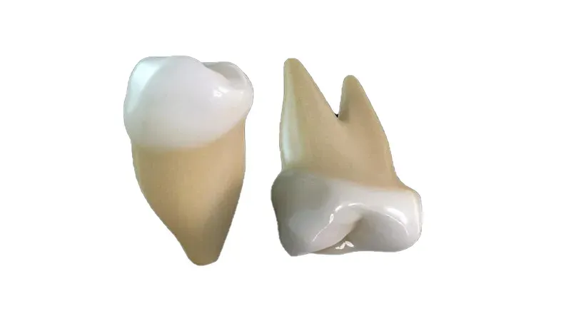 Răng cối có thay không