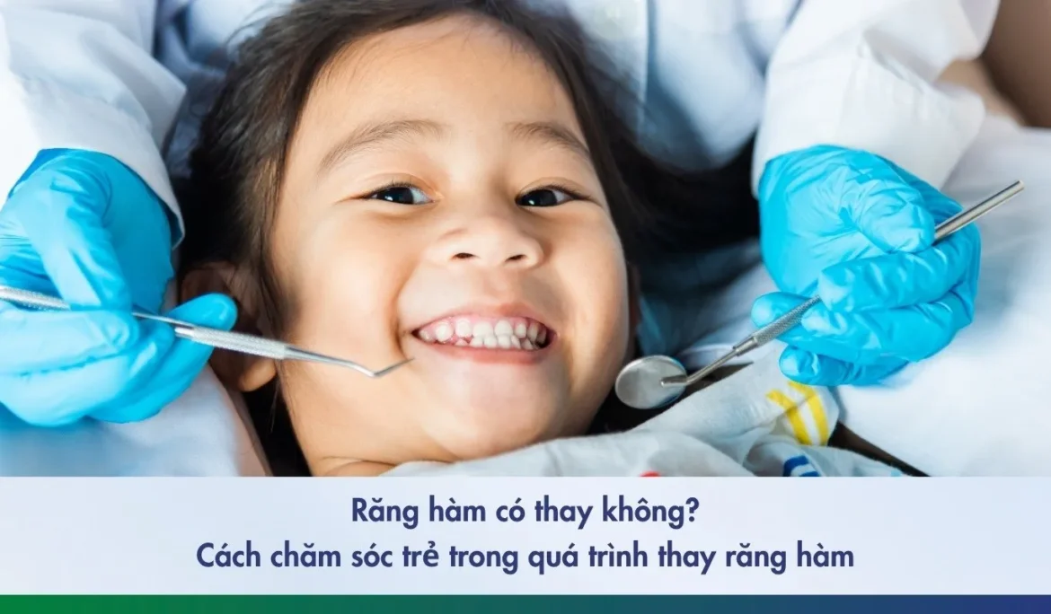 Răng hàm mấy tuổi thay