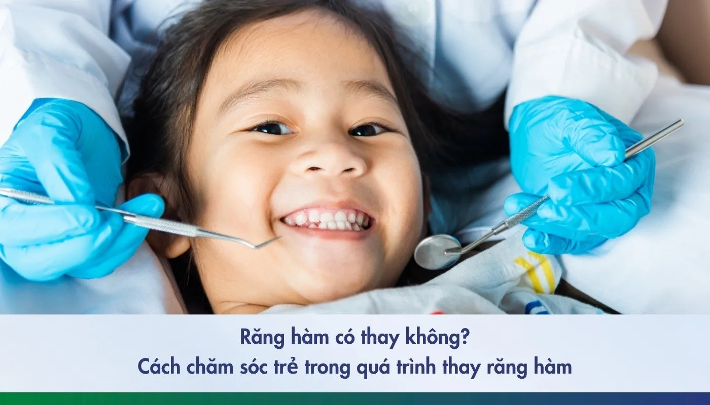 Răng hàm mấy tuổi thay