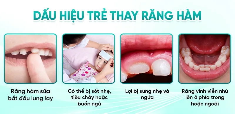Răng hàm mấy tuổi thay