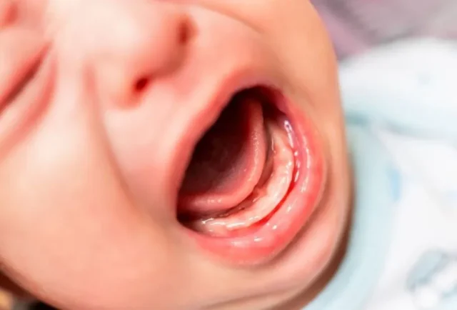 trẻ sốt mọc răng