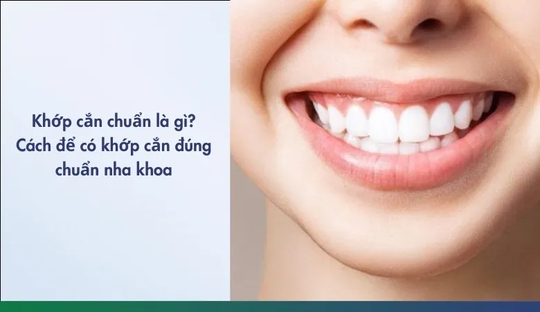 khớp cắn chuẩn