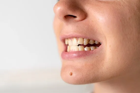 cách để răng mọc nhanh