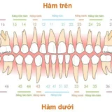 các loại hàm răng
