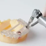 máng hướng dẫn phẫu thuật